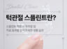 턱관절 스플린트란?