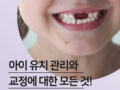 유치 관리에 대한 모든 것