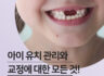 유치 관리에 대한 모든 것