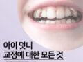 아이 덧니 교정에 대한 모든것