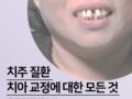 치주질환 치아교정에 대한 모든 것!