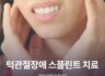 턱관절장애 스플린트 치료 원리 어떻게 될까?