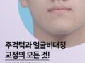주걱턱과 얼굴 비대칭 교정의 모든 것!