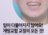 개방교합 교정의 모든 것!