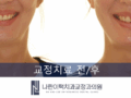 교정 후 틀어짐, 투명교정 사례! 기간은?