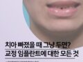 치아 빠졌을 때 그냥 두면? 나란이턱치과에서 알려드리는 교정+임플란트 치료
