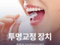 투명교정 장치 종류, 인비절라인