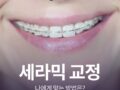 세라믹 교정 나에게 맞는 방법은?