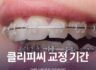 클리피씨 교정 기간, 어떤 사람에게 권장될까?
