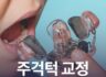 주걱턱 교정 시기 놓치면 안 되는 이유