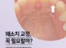 왜소치 교정 꼭 해야할까?