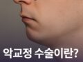 악교정 수술이란? 필요한 경우는?