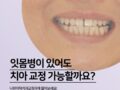 잇몸병이 있어도 치아 교정 가능할까요?
