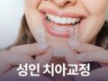 성인 치아교정할 수 있을까?