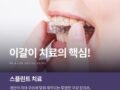 이갈이 치료에 효과적인 스플린트 관리법