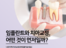 임플란트 치아 교정 순서? 무엇이 먼저일까!