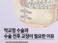 악교정 수술이 필요한 경우와 전후 교정의 의미