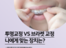 투명교정 vs 브라켓 교정, 나에게 맞는 장치는 무엇일까요?
