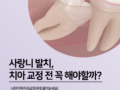 매복 사랑니, 치아 교정 전에 꼭 발치 해야 할까요?