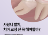 매복 사랑니, 치아 교정 전에 꼭 발치 해야 할까요?