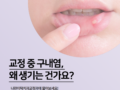교정 중 구내염, 왜 생기고 어떻게 관리해야 할까요?