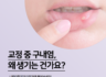 교정 중 구내염, 왜 생기고 어떻게 관리해야 할까요?
