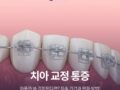 치아 교정 통증 아플까 봐 걱정된다면? 지속 기간과 완화 방법!
