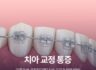치아 교정 통증 아플까 봐 걱정된다면? 지속 기간과 완화 방법!