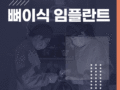 뼈이식 임플란트가 필요한 이유는?