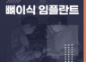 뼈이식 임플란트가 필요한 이유는?