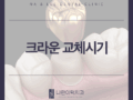 크라운 교체시기, 언제 해야할까요?