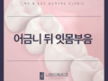어금니 뒤 잇몸 부음 이것이 원인일 수 있어요!