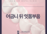 어금니 뒤 잇몸 부음 이것이 원인일 수 있어요!