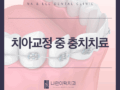 치아교정 중 충치치료 어떻게 받나요?