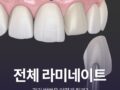 전체 라미네이트 관리 방법은?