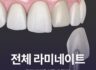 전체 라미네이트 관리 방법은?