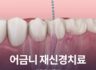 어금니 재신경치료 과정은 어떨까?