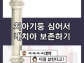 치아 안에 기둥 심어 내 치아 다시 살리기