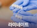 라미네이트 과정 시간 얼마나 걸릴까?