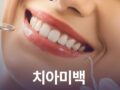 치아미백 어떤 사람이 하면 좋을까?