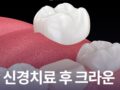 신경치료 후 크라운 종류 왜 덮어씌울까?