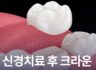 신경치료 후 크라운 종류 왜 덮어씌울까?