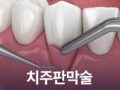 치주판막술 잇몸 염증 치료 꼭 해야 하는 걸까