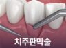 치주판막술 잇몸 염증 치료 꼭 해야 하는 걸까