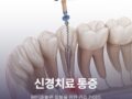 신경치료 통증 걱정 끝! 원인과 빠른 회복을 위한 관리 가이드