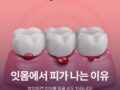 잇몸에서 피가 나는 이유, 방치하면 치아를 잃을 수도 있습니다!