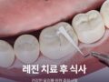 레진 치료 후 식사 가이드와 건강한 유지를 위한 주의사항