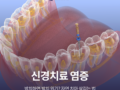 신경치료염증 방치하면 발치 위기? 자연 치아 살리는 법
