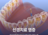 신경치료염증 방치하면 발치 위기? 자연 치아 살리는 법