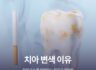 치아 변색 이유, 하얀 미소를 방해하는 원인과 예방법